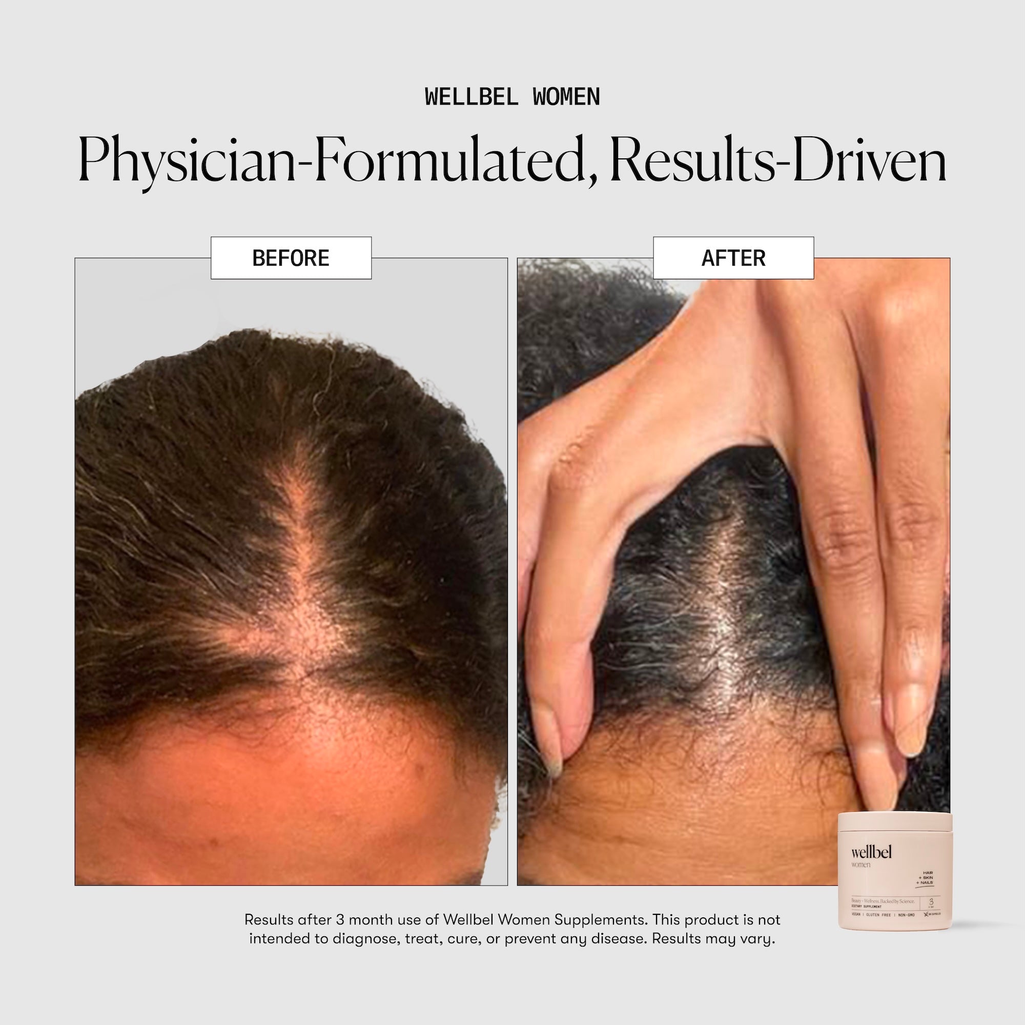 Wellbel Women Bundle