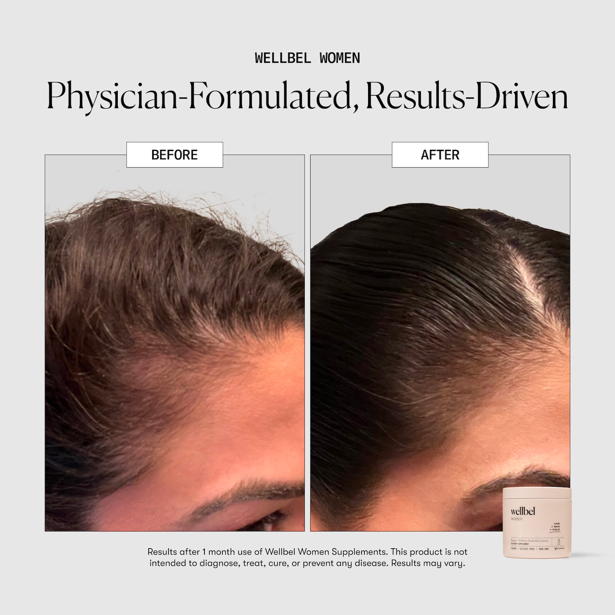 Wellbel Women Bundle