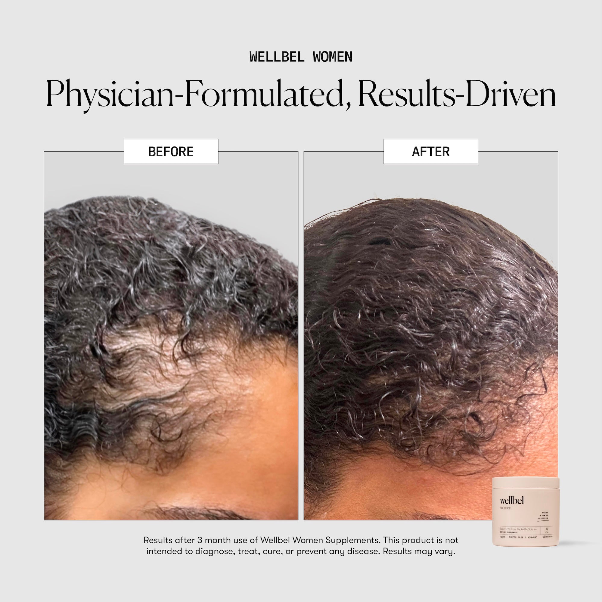 Wellbel Women Bundle