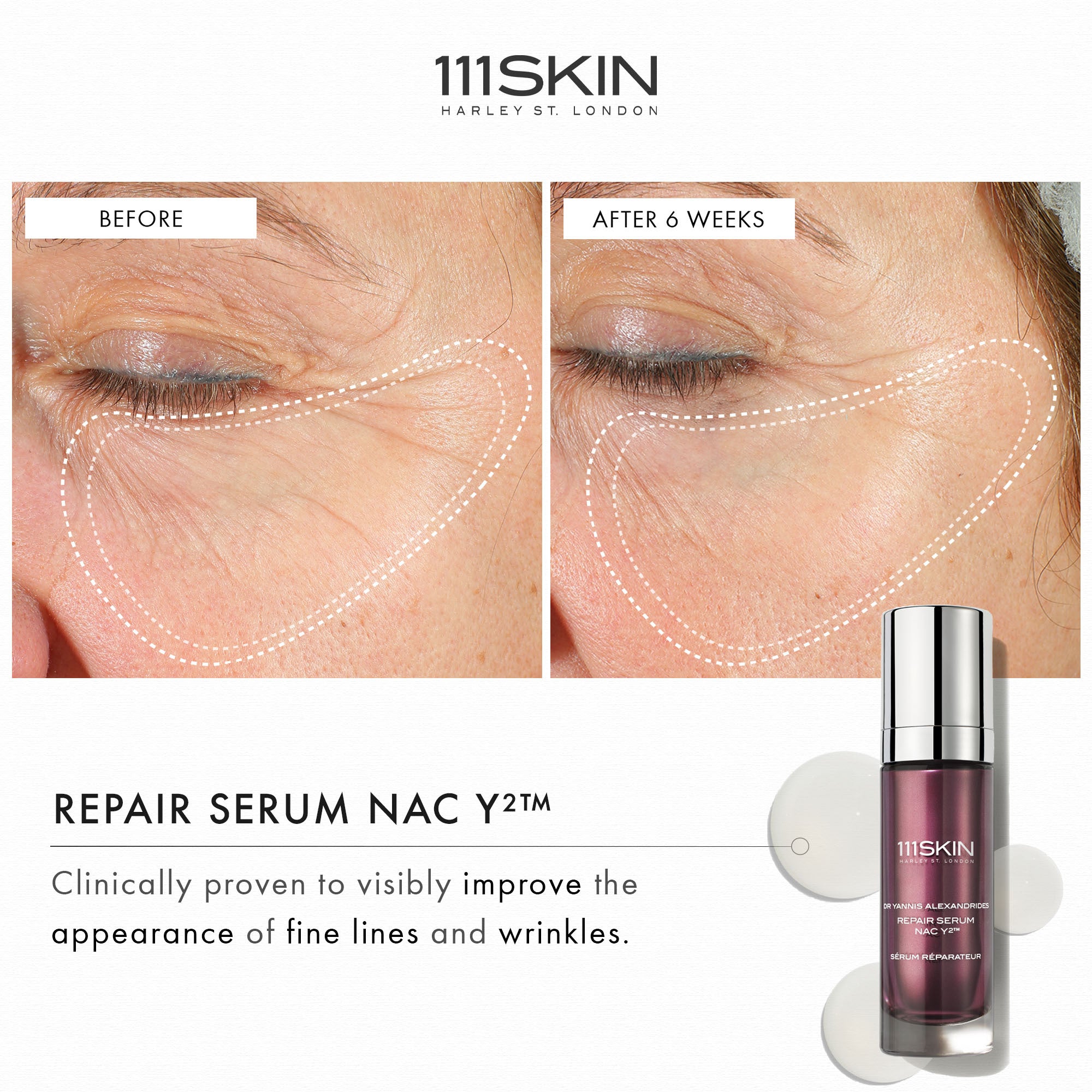 111Skin Repair Serum Nac Y2™