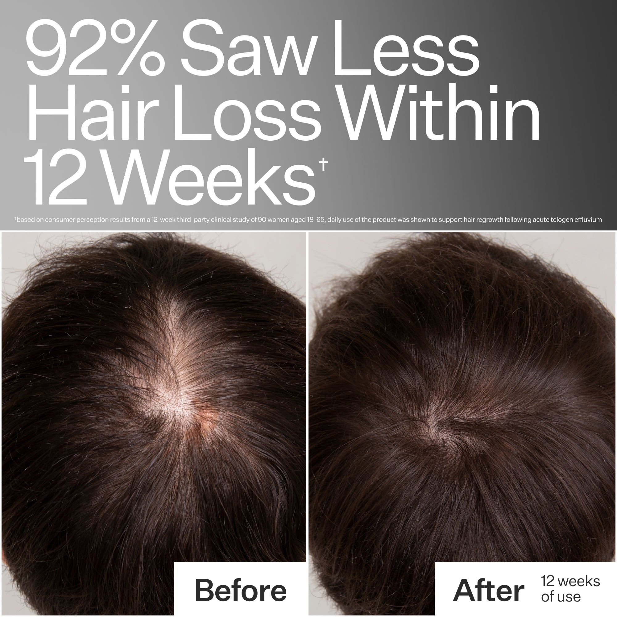 Act+Acre 3% Stem Cell Peptide Treatment