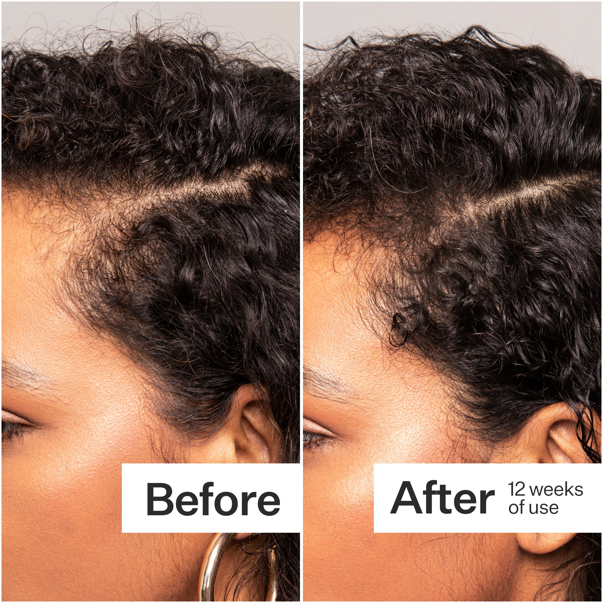 Plant Based Hair Capsules
