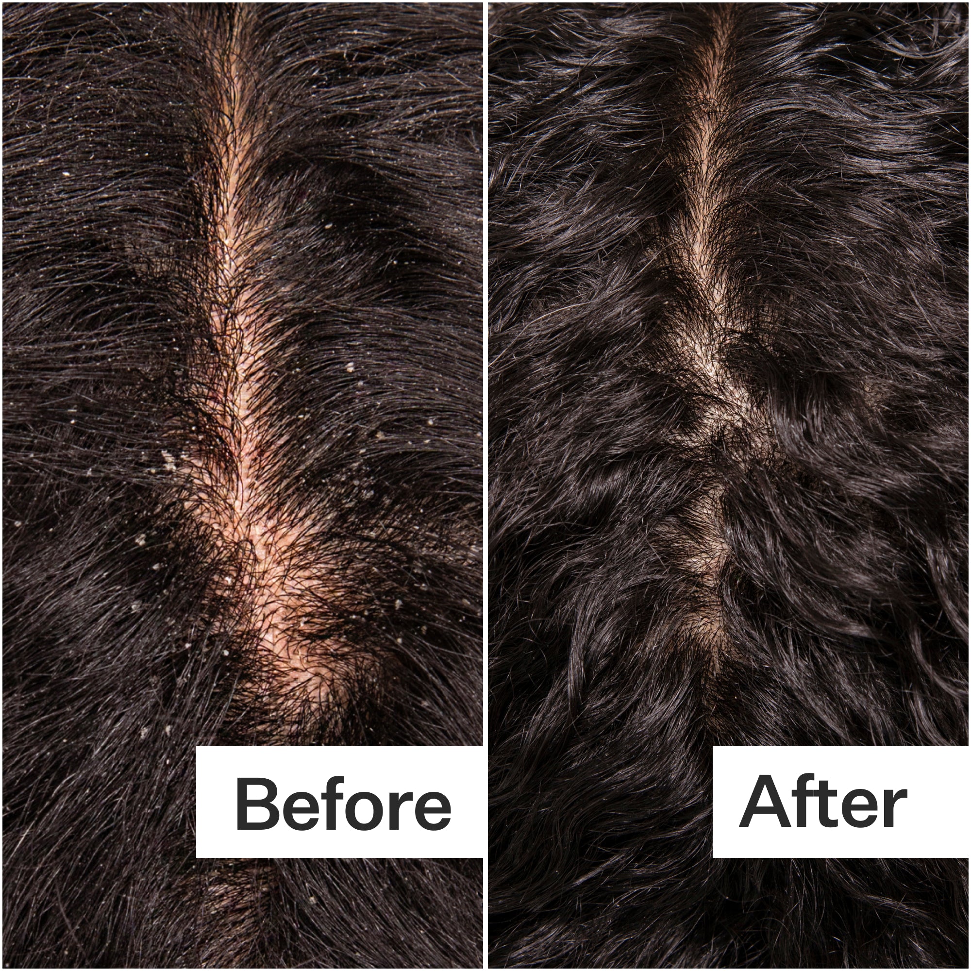 Act + Acre Microbiome Cooling Scalp Serum