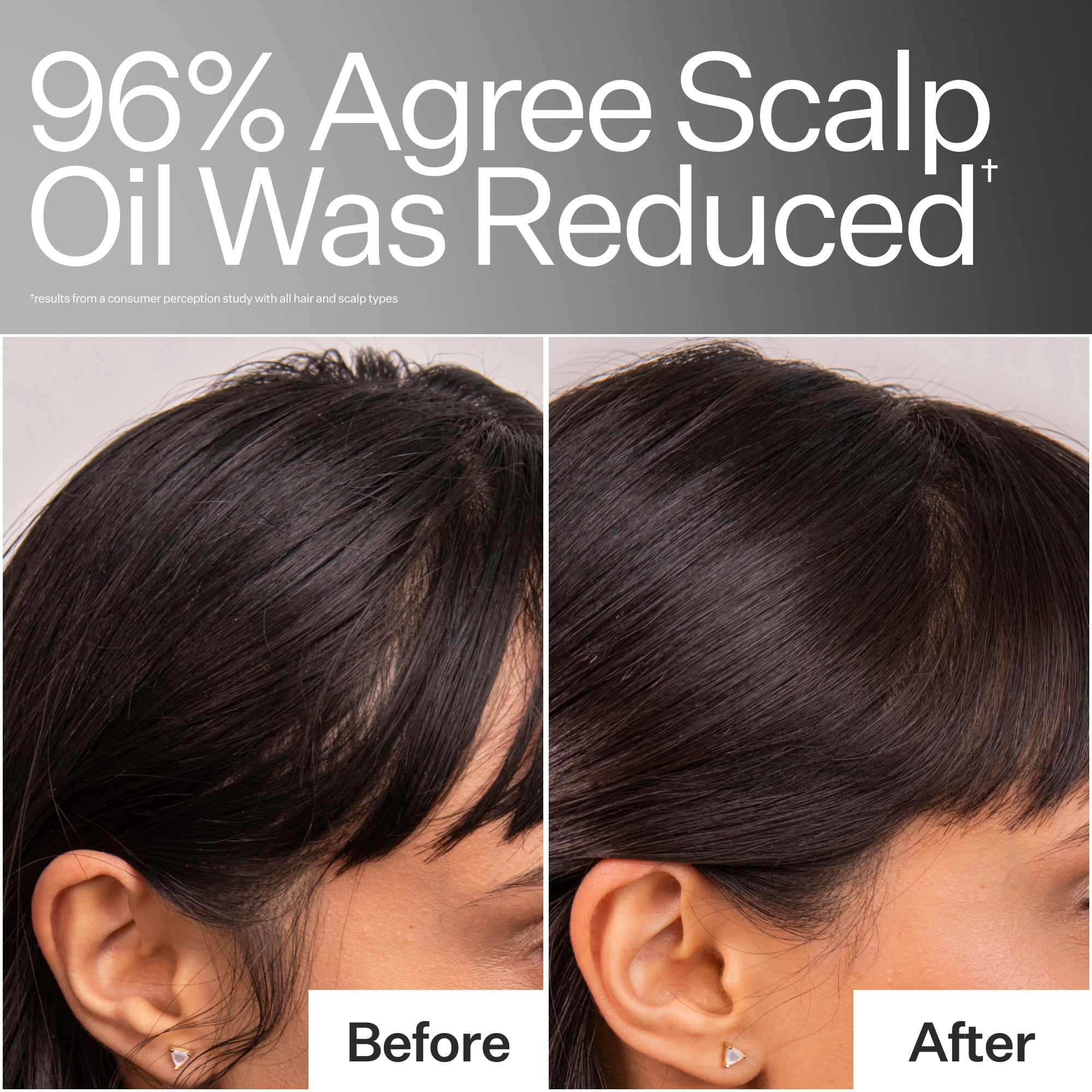 Act+Acre 4% Niacinamide Oily Scalp Serum