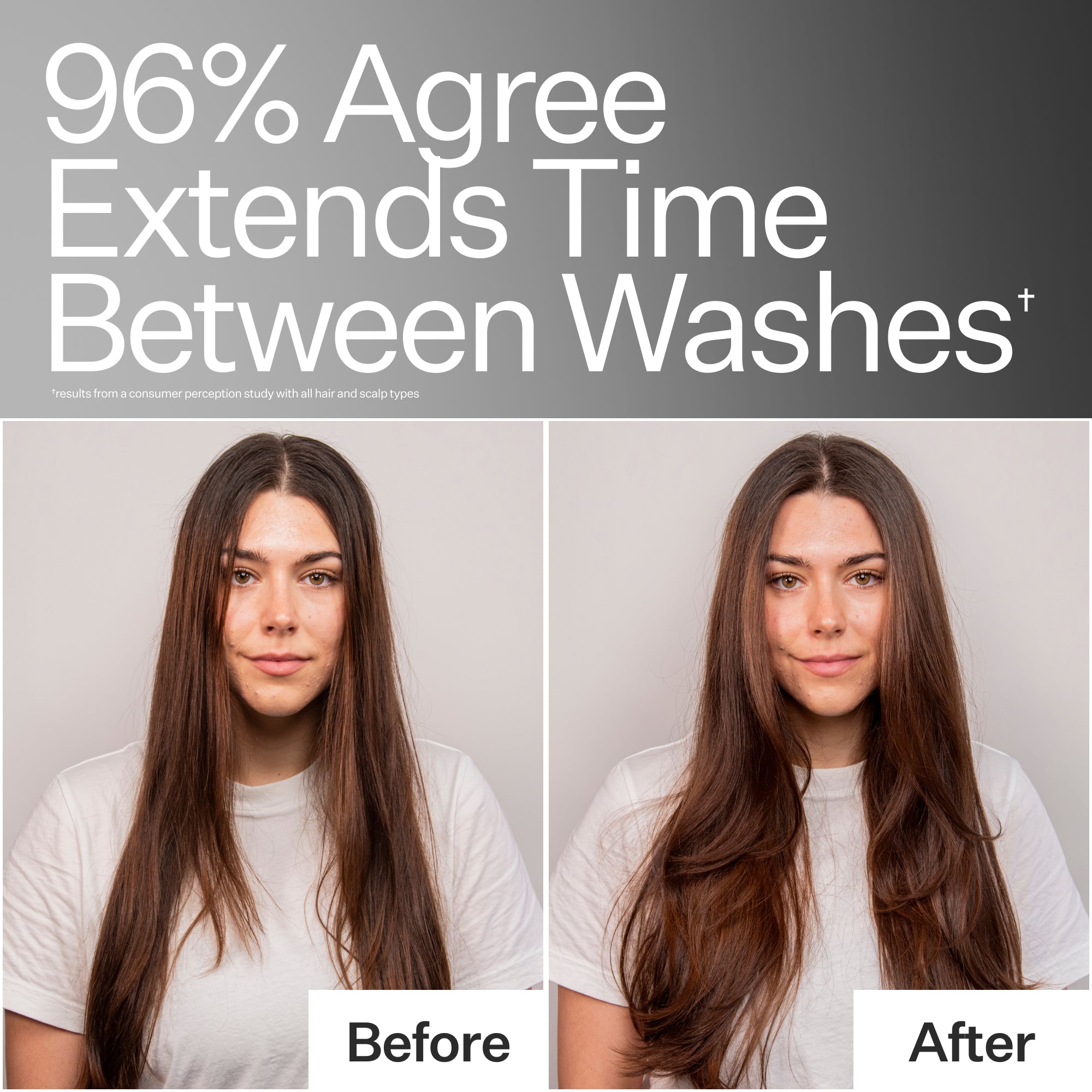 Act+Acre 4% Niacinamide Oily Scalp Serum