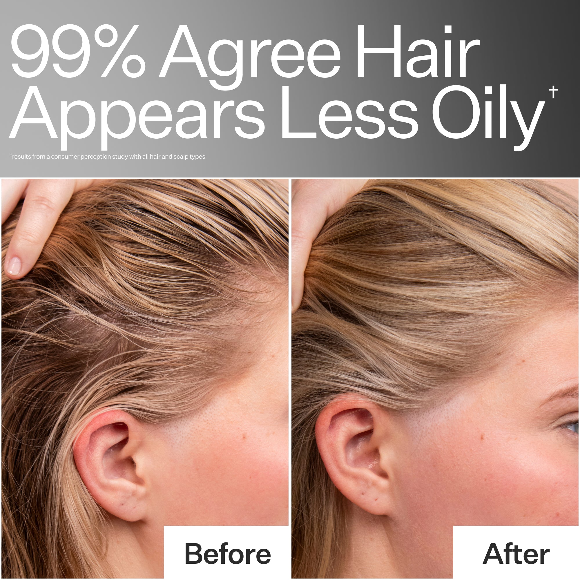 Act+Acre 4% Niacinamide Oily Scalp Serum