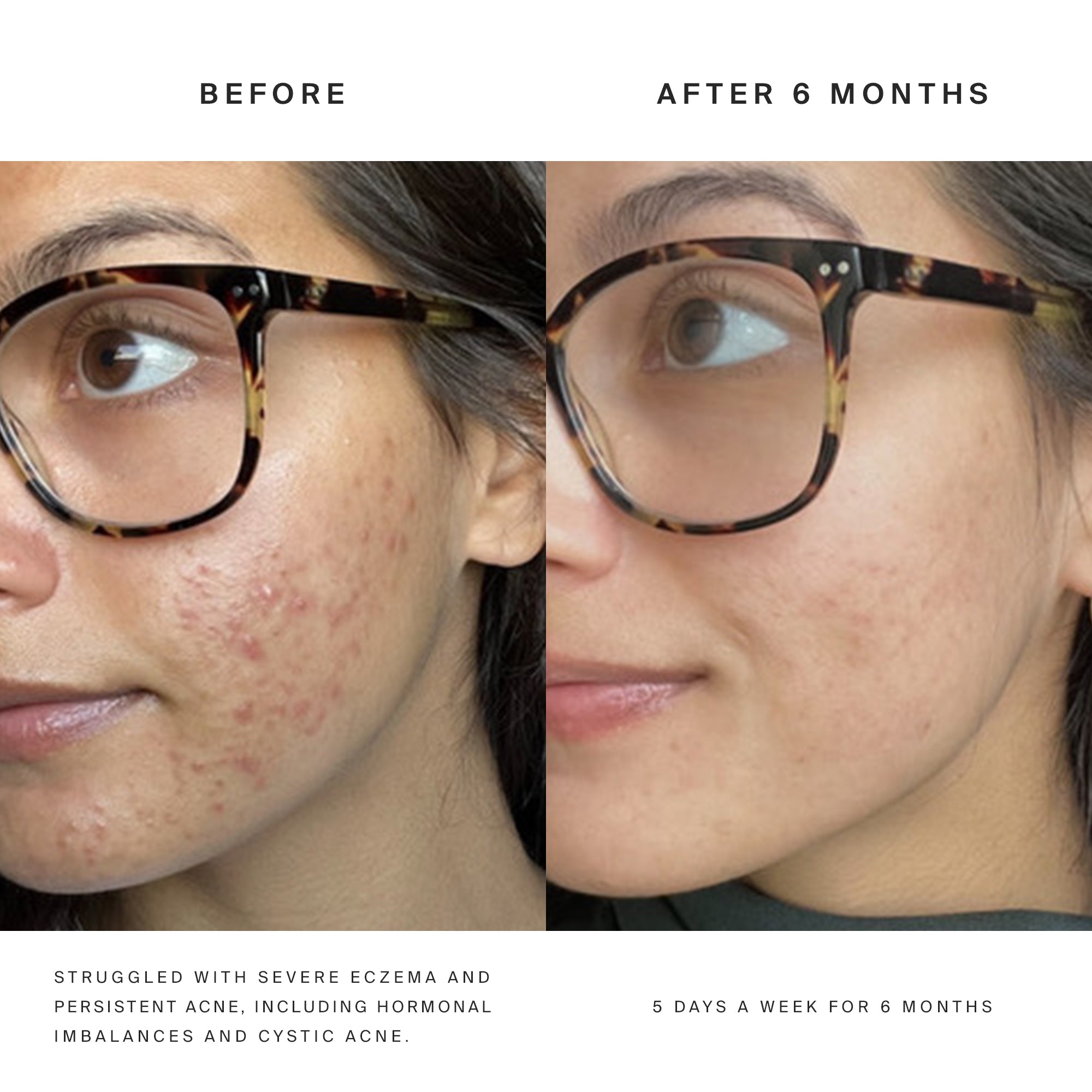 Higherdose Red Light Face Mask