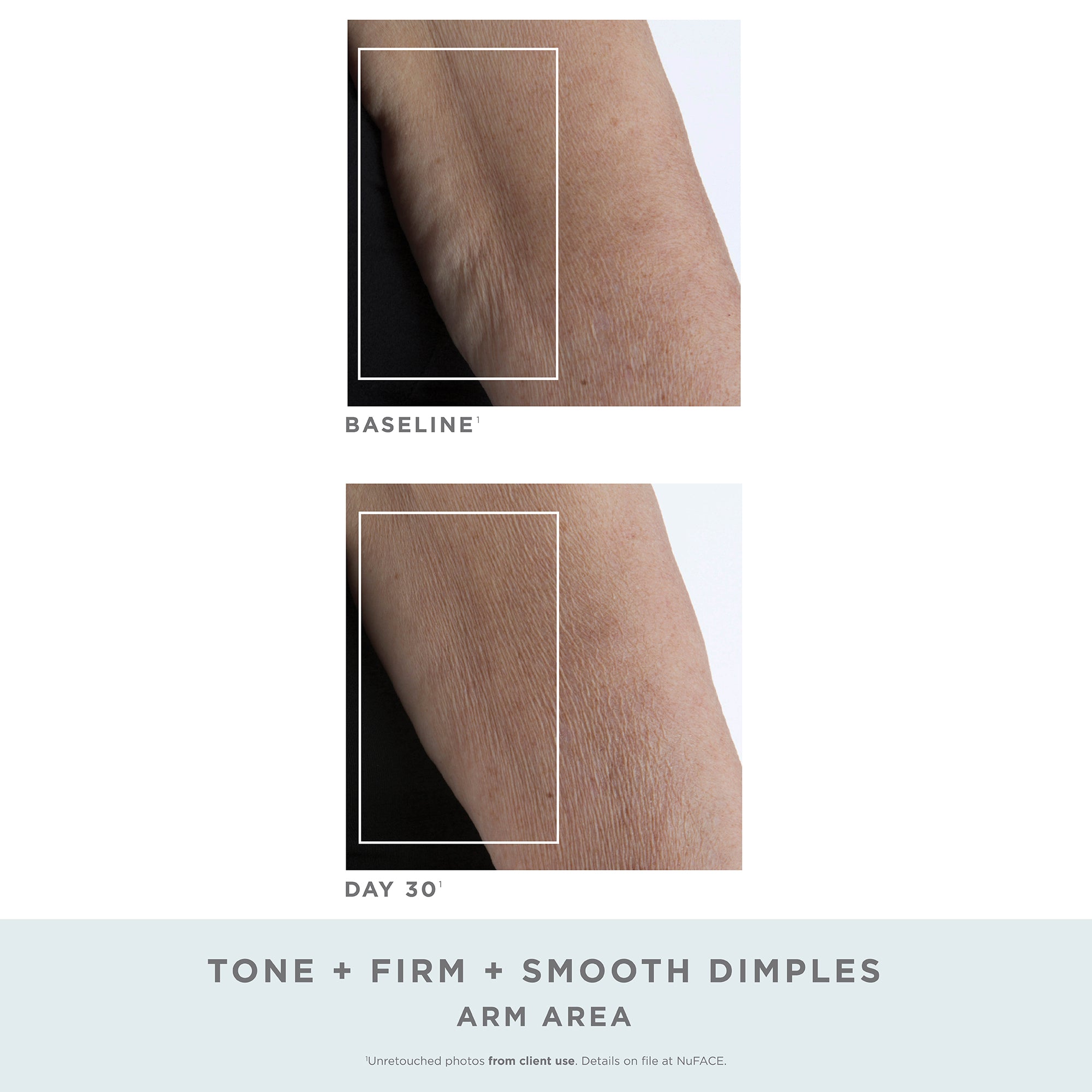 NUFACE NUBODY TONING AND FIRMING KIT